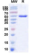 Recombinant Human LBX1 Protein, N-His-KSI