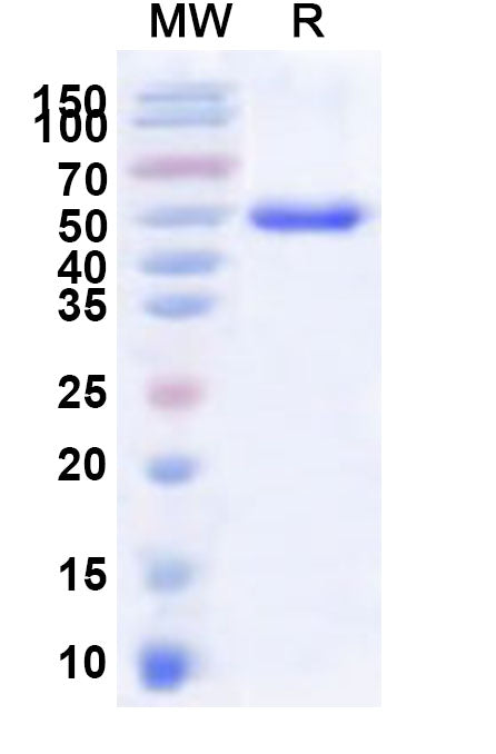 Recombinant Human LBX1 Protein, N-His-KSI