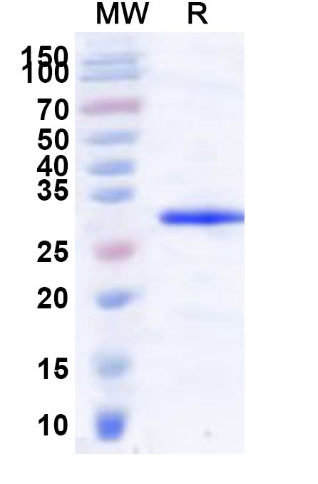 Recombinant Human GRK3 Protein, N-His