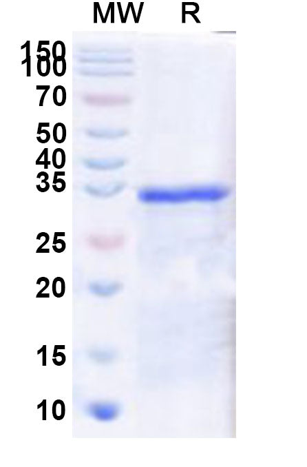 Recombinant Human IRX4 Protein, N-GST & C-His