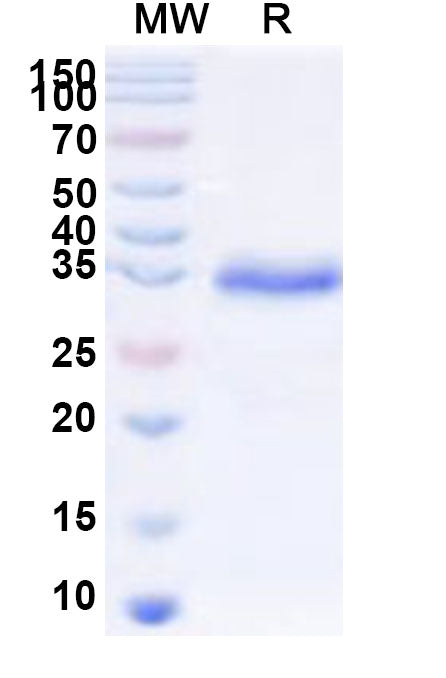 Recombinant Human CREB5 Protein, N-His-KSI