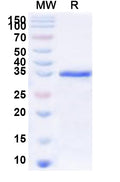 Recombinant Human FOXE3 Protein, N-GST & C-His
