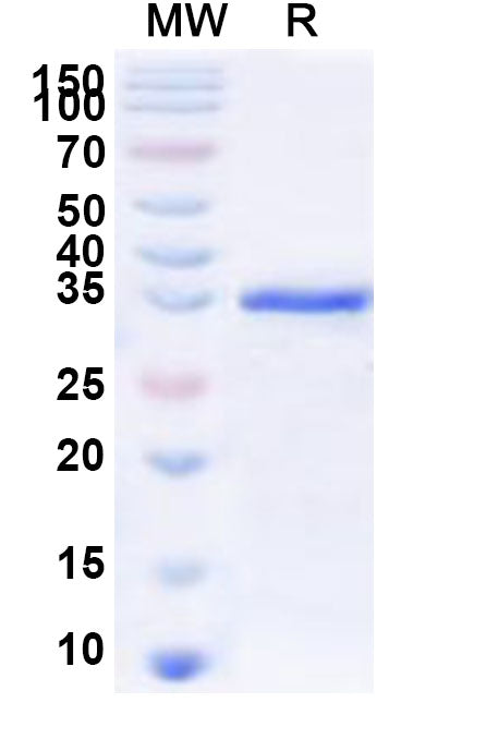 Recombinant Human FOXE3 Protein, N-GST & C-His