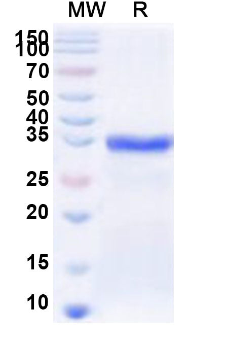 Recombinant Human RIPPLY1 Protein, N-His-KSI