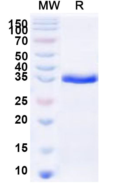 Recombinant Human LAGE3 Protein, N-GST & C-His