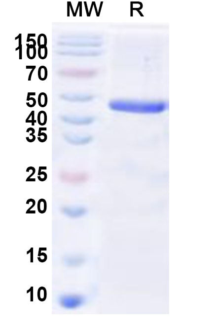 Recombinant Human HES1 Protein, N-His-KSI