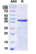Recombinant Human SSX1 Protein, N-GST & C-His