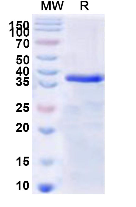 Recombinant Human SSX1 Protein, N-GST & C-His