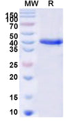 Recombinant Human LIPN Protein, N-His