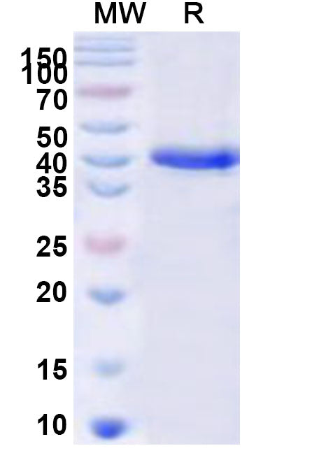 Recombinant Human LIPN Protein, N-His