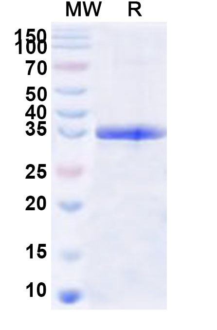 Recombinant Human GNA13 Protein, N-His