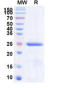 Recombinant Human METTL21C Protein, N-His