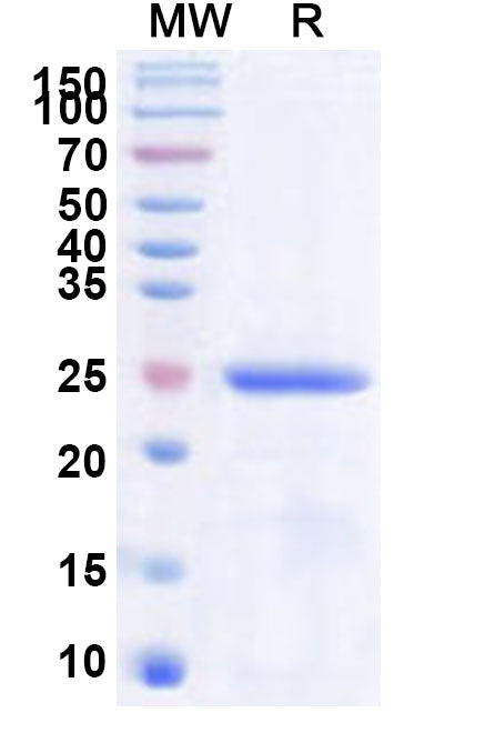 Recombinant Human METTL21C Protein, N-His
