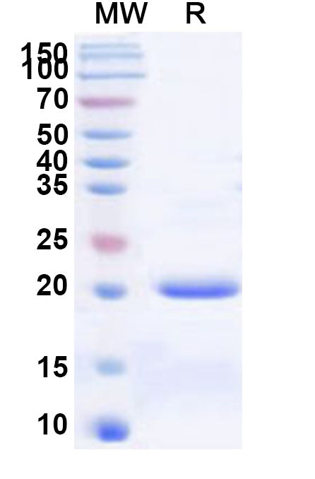 Recombinant Human DCAF15 Protein, N-His