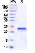 Recombinant Human XAF1 Protein, N-His