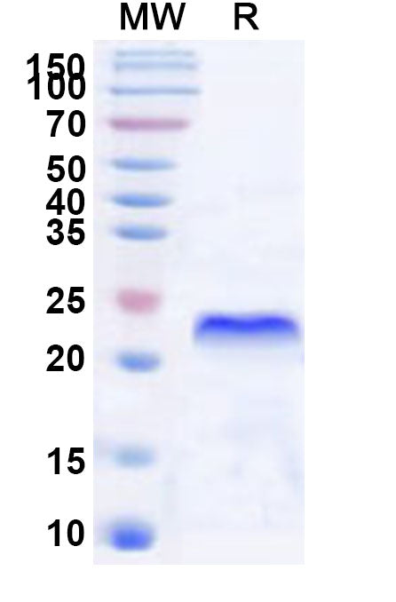 Recombinant Human XAF1 Protein, N-His