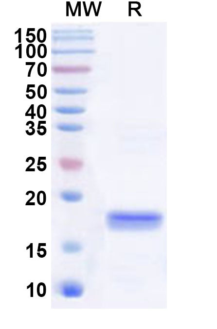 Recombinant Human SLA Protein, N-His