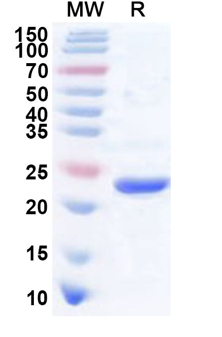 Recombinant Human CTF1 Protein, N-His