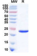 Recombinant Human CBFB Protein, N-His