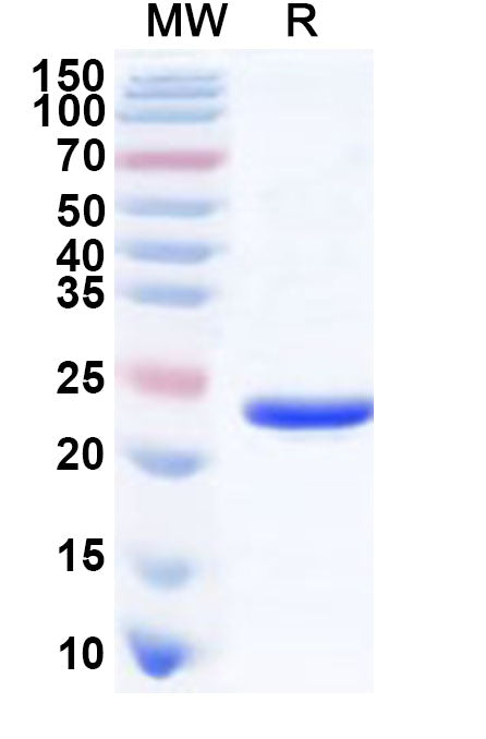 Recombinant Human CBFB Protein, N-His
