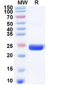 Recombinant Human MEX3C Protein, N-His