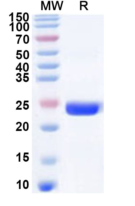 Recombinant Human MEX3C Protein, N-His