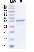 Recombinant Human SHPRH Protein, N-His