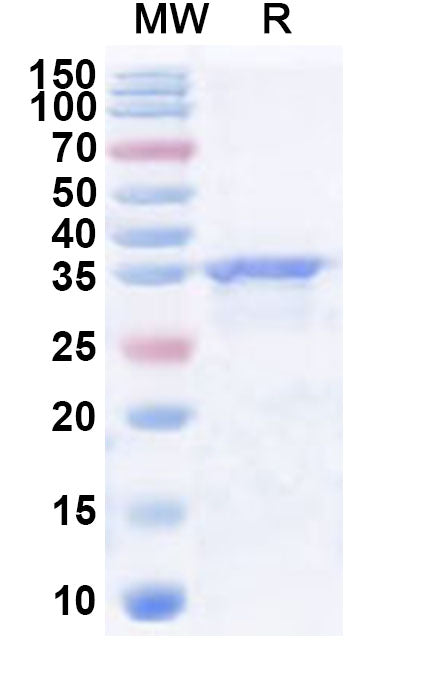Recombinant Human SHPRH Protein, N-His
