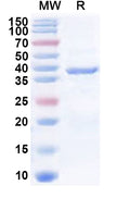 Recombinant Human CDK10 Protein, N-His