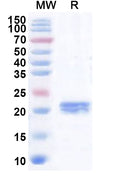 Recombinant Human ABRAXAS2 Protein, N-His