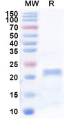 Recombinant Human TRIP6 Protein, N-His