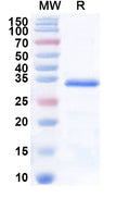 Recombinant Human SNAPC1 Protein, N-His