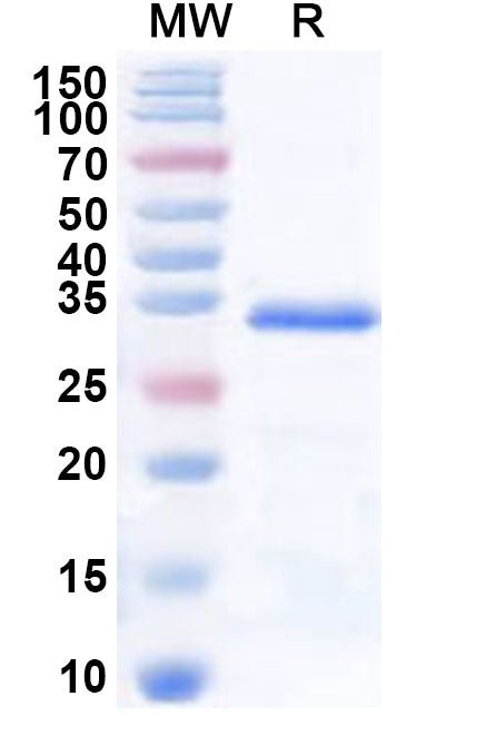 Recombinant Human SNAPC1 Protein, N-His