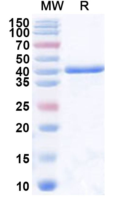 Recombinant Human MAN2A1 Protein, N-His