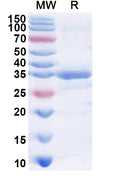 Recombinant Human PHKG1 Protein, N-His