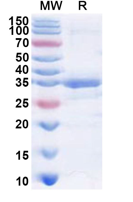 Recombinant Human PHKG1 Protein, N-His
