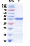 Recombinant Human TKFC Protein, N-His