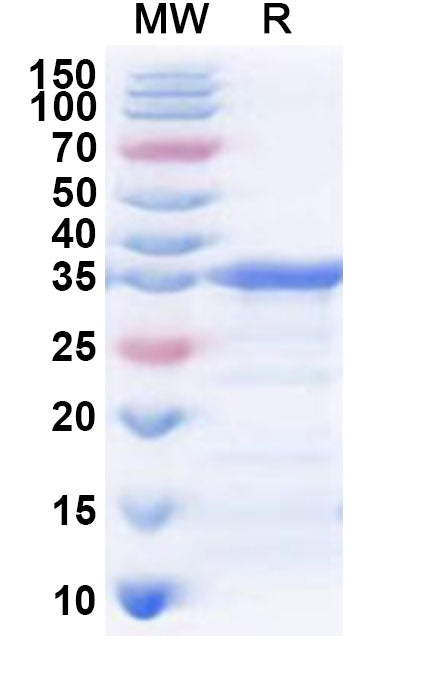 Recombinant Human TKFC Protein, N-His