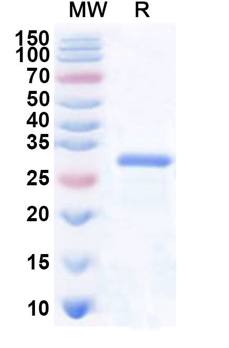Recombinant Human RNF187 Protein, N-His