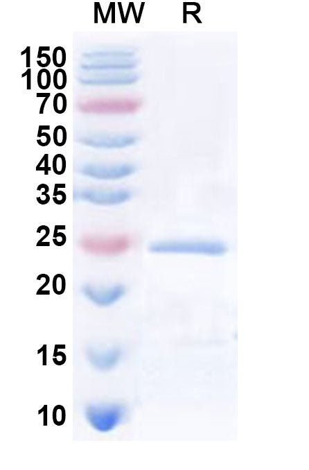 Recombinant Human SLC5A3 Protein, N-His-KSI
