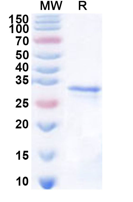 Recombinant Human DNASE1L3 Protein, N-His