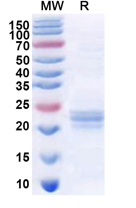 Recombinant Human RAB38 Protein, N-His