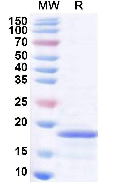 Recombinant Human PLEKHS1 Protein, N-His