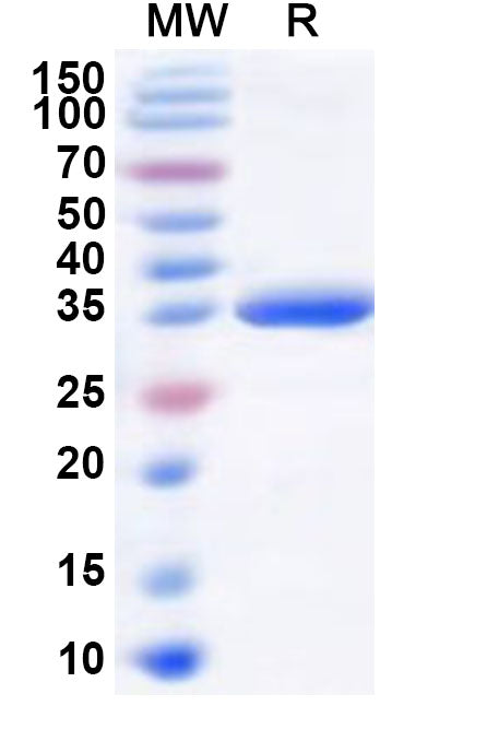 Recombinant Human RBM33 Protein, N-GST & C-His