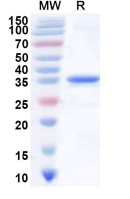 Recombinant Human IER3 Protein, N-GST & C-His