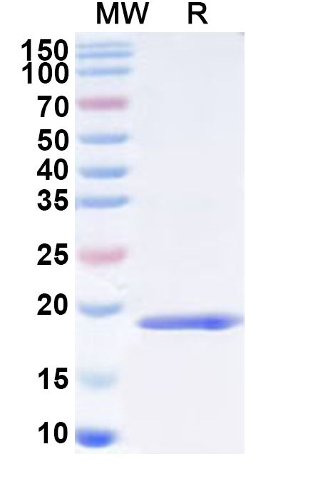Recombinant Human POLR2H Protein, N-His