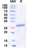 Recombinant Human NR2F6 Protein, N-His