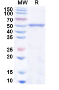 Recombinant Human CYP2C9 Protein, N-His