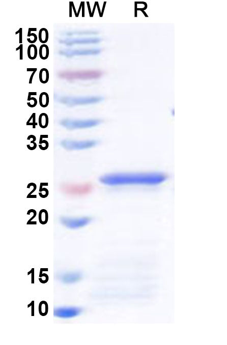 Recombinant Human SMARCA4 Protein, N-His