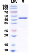 Recombinant Human PHF2 Protein, N-His